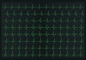Gráfico de pulso cardíaco