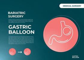 balão gástrico de endoscopia de estômago dentro de uma cirurgia de perda de peso de estômago ilustração vetorial obesidade