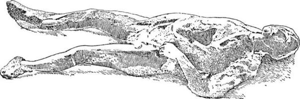 molde de um corpo encontrado em pompeia, ilustração vintage. vetor