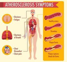 Estágios da aterosclerose infográfico vetor