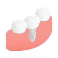 ícone de implante dentário, estilo 3d isométrico vetor