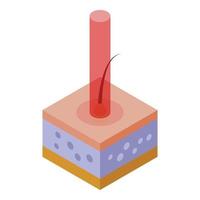 ícone do processo de depilação a laser, estilo isométrico vetor