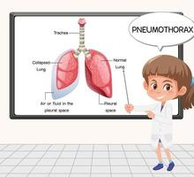 jovem cientista explica pneumotórax em frente a uma placa de laboratório vetor