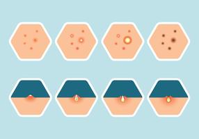 Conjunto de ícones de pimples