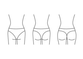 tipos de mulher de bunda, forma de nádega para trás, ícone de linha. aumento, remodelar as nádegas de pequeno, plano no saque completo. procedimentos médicos cosméticos, clínica de cirurgia plástica. ilustração de contorno vetorial vetor