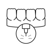 ilustração vetorial de ícone de linha de tratamento a laser de dentes de estomatologia vetor