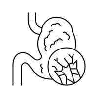 ilustração vetorial de ícone de linha de mesotelioma de inchaço abdominal vetor