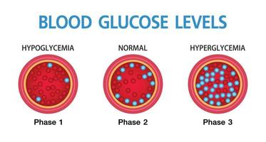 hiperglicemia, açúcar elevado no sangue e diabetes, a obesidade é uma causa grave de condição médica, design vetorial. vetor