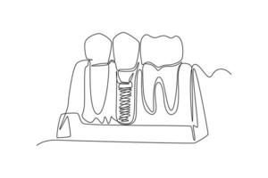 contínuo 1 linha desenhando dentes com dental implantar. dental saúde conceito. solteiro linha desenhar Projeto vetor gráfico ilustração.