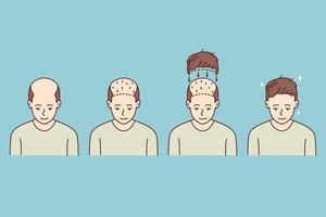 estágios em homem cabelo transplante. tratamento do calvície e alopecia. conjunto do masculino paciente folicular unidade Extração. vetor ilustração.