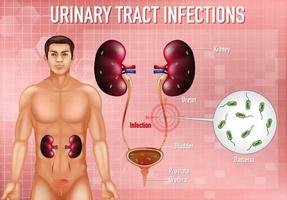 ilustração informativa de infecções do trato urinário vetor