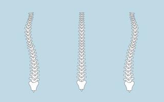 humano coluna vertebral dentro normal e com escoliose vetor