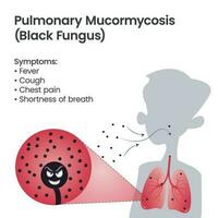 pulmonar Preto fungo ou mucormicose desenho animado vetor ilustração infográfico