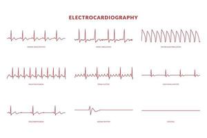 eletrocardiografia batimento cardiaco linha monitor. vetor eps10 ilustração