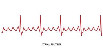 ecg batimento cardiaco linha. eletrocardiograma vetor ilustração. atrial vibração