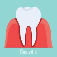 gengivite, Chiclete doença isolado ilustração vai dente. dental Cuidado, estomatologia problema conceito. vetor