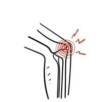 mão desenhado rabisco osso articulação dor ilustração vetor
