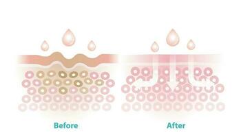 antes e depois de cuidados com a pele reduzir rugas vetor ilustração isolado em branco fundo. Cruz seção do rugas pele e cuidados com a pele absorvente para Socorro reduzir envelhecimento e estragado pele.