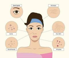 pele Solução de problemas acne tratamento e limpeza vetor