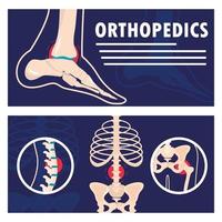 ortopedia anatomia humana vetor