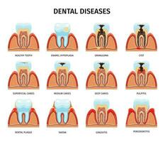 dental anatomia problemas conjunto vetor