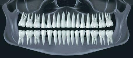 realista dentes raio X vetor