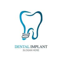 dental implantar logotipo Projeto conceito vetor, dental Cuidado logotipo modelo vetor