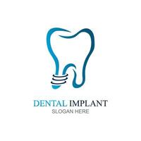 dental implantar logotipo Projeto conceito vetor, dental Cuidado logotipo modelo vetor