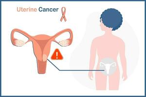 médico vetor ilustração conceito dentro uterino Câncer conceito. vetor ilustração do útero e mulher em branco fundo.