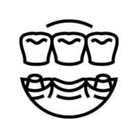 ponte dental procedimento linha ícone vetor ilustração