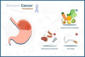 médico vetor ilustração do estômago Câncer dentro estômago Câncer prevenção conceito.comer bastante frutas e vegetais, limitado salgado e defumado alimentos, pare fumar.ilustração dentro plano estilo