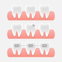 dental Cuidado conceito. crédito cartão ícone. vetor Projeto. médico seguro cartão ícone