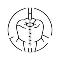 ilustração vetorial de ícone de linha de tratamento de canal radicular vetor