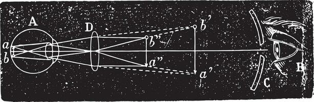 oftalmoscópico exame estava a invertido imagem, vintage gravação. vetor