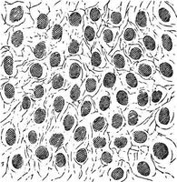 glioma, vintage gravação. vetor