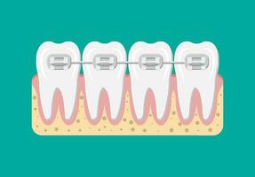 dentes aparelho ortodôntico. ortodontia e odontologia. humano dente dentro plano estilo. dental conceito. higiene e higiene bucal. vetor ilustração