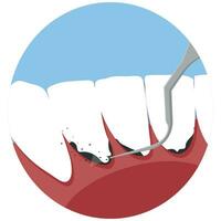 profissional dentes limpeza vetor ilustração. livro a compromisso para dentes limpeza