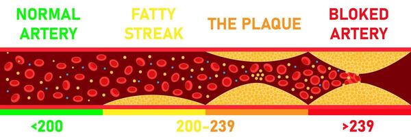 colesterol nível em bloqueado sangue embarcação médico mau hdl lipoproteína. Alto e baixo gordo teste indicador. aterosclerose risco. cuidados de saúde conceito. vetor ilustração