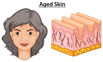 Diagrama mostrando mulher com pele envelhecida vetor