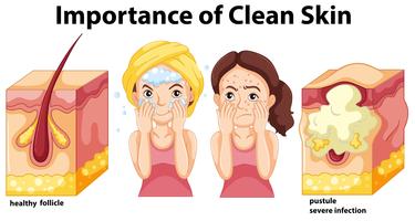 Importância do conceito de pele limpa vetor