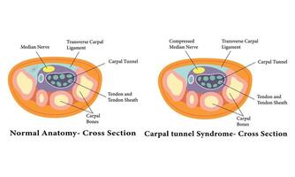 carpal túnel anatomia diagrama ilustração Projeto. vetor