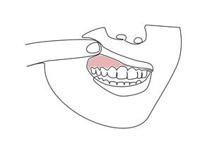 mulher boca oral dental doença Chiclete avermelhado doença linha arte vetor