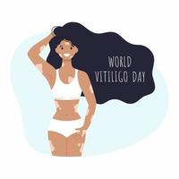 linda garota em um maiô e com vitiligo. a inscrição dia mundial do vitiligo em 25 de junho. uma mulher tem vitiligo. ilustração vetorial sobre o tema das doenças raras. vetor