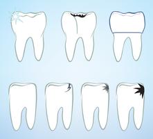 Conjunto de dentes. Sinal de dentes brancos. Coleção isolada médica dental. vetor