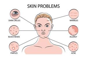 infográficos de problemas de pele vetor