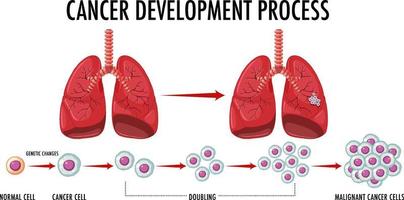 processo de infográfico de desenvolvimento de câncer vetor