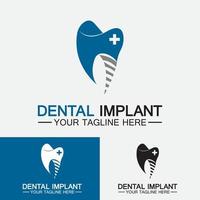conceito de design de vetor de logotipo de implante dentário