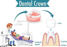 infográfico de humano em coroa dental em fundo branco vetor