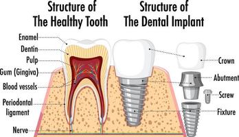 infográfico de humano na estrutura do dente saudável vetor