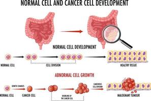 diagrama mostrando células normais e cancerosas em humanos vetor